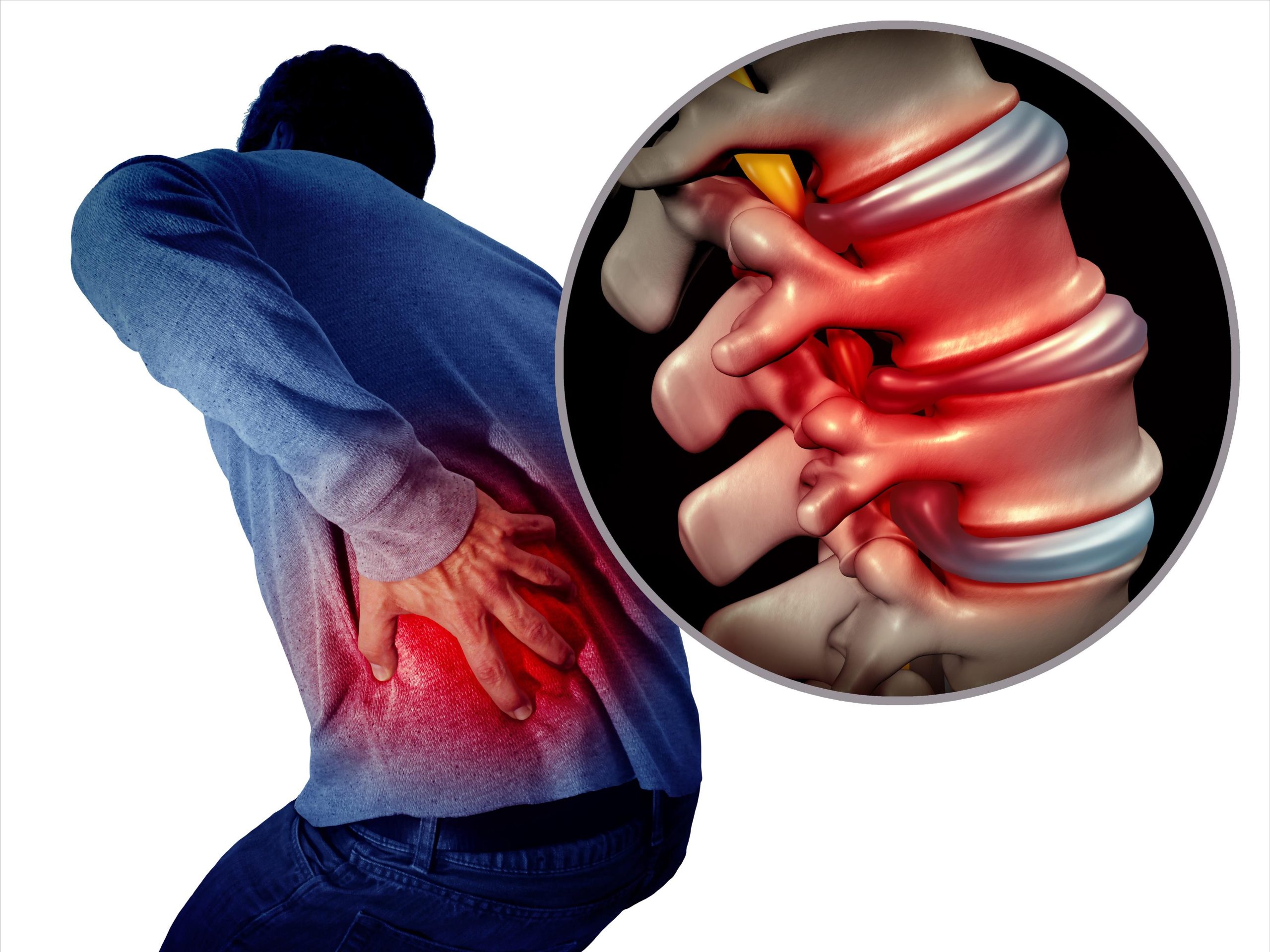 How to prevent lumbar disc herniation? Complete analysis of daily posture and exercise!